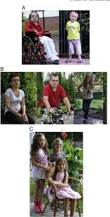 Figure 2 From Mucopolysaccharidosis Type Vi A Cardiologist S Guide To Diagnosis And Treatment Semantic Scholar