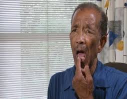 Happy ending after VA dental screw-up leaves 86-year-old eating soup for  months