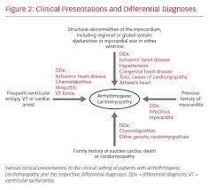 The possible pathophysiology and proposed guideline. Arrhythmogenic Cardiomyopathy A Disease Or Merely A Phenotype Ecr Journal