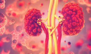 treatment for polycystic kidney disease shows promising results