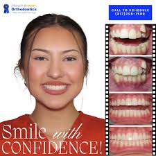 New Year…New You! A lot of people think that orthodontic treatment is  purely cosmetic, but that is only one of the many benefits of aligning your  teeth. Teeth that are aligned well