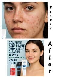 Let's welcome our new members! Just a quick reminder: this group is for  people who are interested in approaches to knotweed WITHOUT USING TOXIC  HERBICIDES. Anyone advocating the use of herbicides will