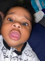 When I was a child and got sick with anything (tonsillitis and bronchitis  were common culprits), I remember laying