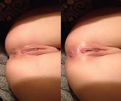 Anus Before and After anal (61 photos) - porn photo