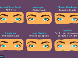 pupil size and your health