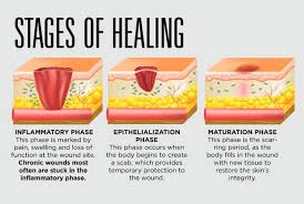 Find a las vegas, nv provider and schedule an appointment in minutes. Doctors Battling An Epidemic Of Wounds That Won T Heal Las Vegas Sun Newspaper