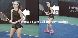 That was kind of fun. Mihaela Buzarnescu Patented Stem Cell Therapy Patches Facebook