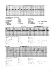 Elektrokardiograf (ekg) merupakan suatu alat yang berfungsi untuk melihat potensial listrik yang dialirkan ke jantung. Latihan Interpretasi Ekg A 10