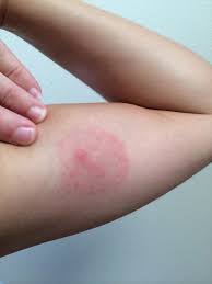 Sodbrennen Geht In Sekunden Weg Dank Dieses Tricks Und 19 Weitere Geniale Tipps Mit Dem Selben Hausmittel Hausmittel Tipps Hilfe Im Haushalt