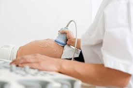 Plasenta Previa Gejala Penyebab Dan Mengobati Alodokter