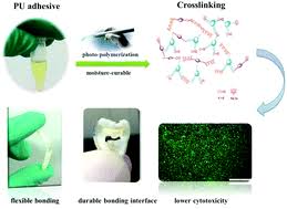 Rao 'mi jedc 'n pu^carie. Photopolymerizable And Moisture Curable Polyurethanes For Dental Adhesive Applications To Increase Restoration Durability Journal Of Materials Chemistry B Rsc Publishing