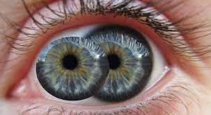 goz bebegi hastaliklari belirtileri ve tedavisi