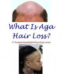 It covers the grey hair effectively. Dht Hormone And Hair Loss Does Black Tea Cause Hair Loss I Stopped My Hair Loss Hair Loss Concealer Singapore Hair Hair Loss Causes Hair Loss Help Hair Loss