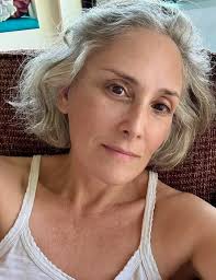 Ricki Lake, 56, has unveiled the incredible results of a deep-plane lower  face and neck lift she underwent a year ago. “I had lost 40 lbs and did not  like the extra