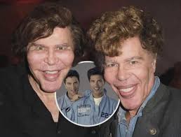Bogdanoff twins 40 year “natural” transformation, as they denied ever  having undergone plastic surgery. 🤔