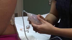 Como Cuidar Un Sistema De Drenaje De Heridas Postoperatorio Y Un Aposito Cutie Youtube