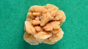 In Minnesota 1 Million Urinary Stones And Counting