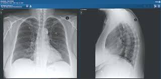 Https Www Canhealth Com Wp Content Uploads 2019 06 Canadian Healthcare Technology 2019 01 Pdf