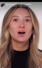 Holy buccal fat removal from Kelli Anne : r/NYCinfluencersnark