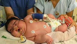 Be the first to contribute! Elle Accouche D Un Bebe De 6 Kg Toutes Les Femmes N En Sont Pas Capables Le Plus