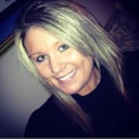 Aloe Vera vs. Coconut Oil: Benefits and Uses! Which Is better?