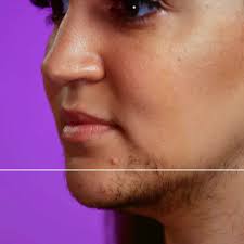 Dr Isha Bad Hair Day