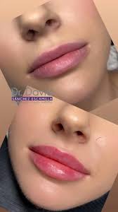 DR DAVID SÁNCHEZ ESCAMILLA (@dr.davidsanchezescamilla) • Instagram photos  and videos