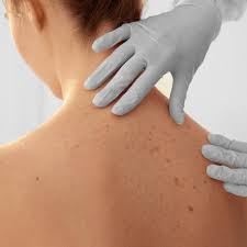 Karin Germe Abdominoplasti Izmir Ekol Hastanesi