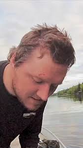 Always wear your sunglasses when you go fishing 😎 #fishing #bassfishing  #accident #injuries #protection #protectyourself #outdoors #reels  #instareels #instagram