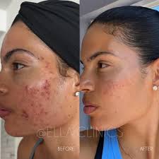 Ella Clinics Curaçao