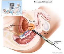 Image result for how to insert male organ into female organ