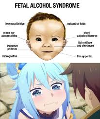 Folds epicanthal bridge researchgate nasal flat foetal c022 syndrome alcohol science library artwork. Then This Means Oh No Animemes