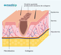 Resultado de imagen para cicatriz