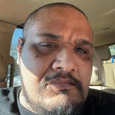 Update: Last day of radiation! Next week will be a week of rest and some  much-needed healing, and then back to chemo the following week. Then we'll  wait a week or two