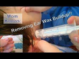 How to remove ear wax. Removing Ear Wax Buildup At Home Flushing Out Ear Wax W Hydrogen Peroxide Ear Irrigation Review Youtube