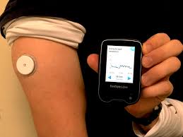 Abbott S Freestyle Libre Transforming Glucose Monitoring Through Utter Simplicity Fingersticks Aside Diatribe