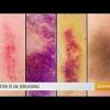 Senile purpura technically comes from sun damage, but similar bruises can show up with regular use of certain medications. Https Encrypted Tbn0 Gstatic Com Images Q Tbn And9gctt Nemwaiyfnoozm398543gtn6txtlc2htgfhaukerk0rkjya4 Usqp Cau