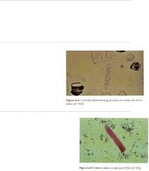 Grátis: URINÁLISE - EXAME MICROSCÓPICO - Material Claro e Objetivo em PDF  para Estudo Rápido