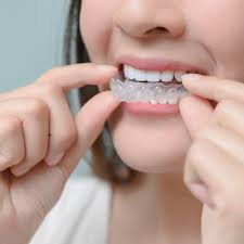 Choose dye from the above option (choose from: What Are Diy Braces And Three Reasons They Re A Bad Idea Wavescape Orthodontics
