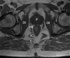 These are separated by cartilage at birth and fuse during puberty. Mri Of The Male Pelvic Floor Radiographics