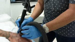 Micro movers is your local sunshine coast furniture removals specialist. My Hand Was A Mess It Was Just Melted Skin Pretty Much The Courier Mail