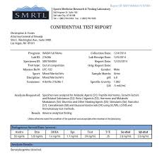 Urine is the most common sample type used for drug testing by employers. Pic Jon Jones Ufc Drug Test Results Released Include Watery Sample And Shrinking T E Levels Mmamania Com