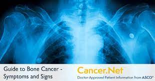 It'll also let him know if you have a fever or infection. Bone Cancer Sarcoma Of Bone Symptoms And Signs Cancer Net