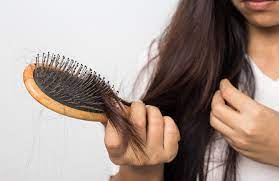 This type of hair loss usually runs in. Iron Deficiency Gluten And Hair Loss Nuvida Hair Studio
