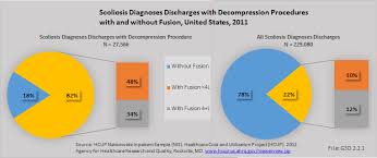 Juvenile Idiopathic Scoliosis Bmus The Burden Of