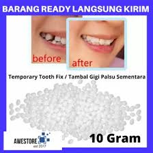 Jangan menggunakan gigi palsu sebelum tau 4 hal penting berikut. Jual Produk Tambal Gigi Termurah Dan Terlengkap Mei 2021 Bukalapak