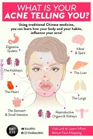 Do You Ever Wonder Why Those Acne Breakouts Appear At The Same Spot The Concept Of Face Mapping Can Exactly Tell You How Different Face Acne Beauty Skin Care Routine Acne