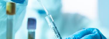 The two main branches detect either the presence of the virus or of antibodies produced in response. Clinical Covid 19 Testing Eurofins Scientific