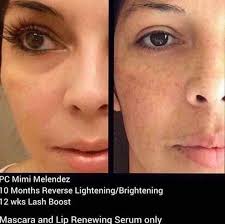 Nicole Gainer-Rodan+Fields Consultant