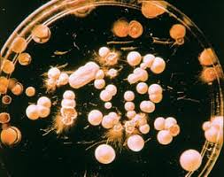 Darmpilze Diagnose Ist Noch Keine Krankheit Mangelerscheinungen Bei Darmpilzen Candida Ursachen Behandlung Pilzdiat Knoblauch Darmpilz Diat Hefeteig Zu Wenig Bifidobakterien Im Stuhl Ugb Gesundheitsberatung